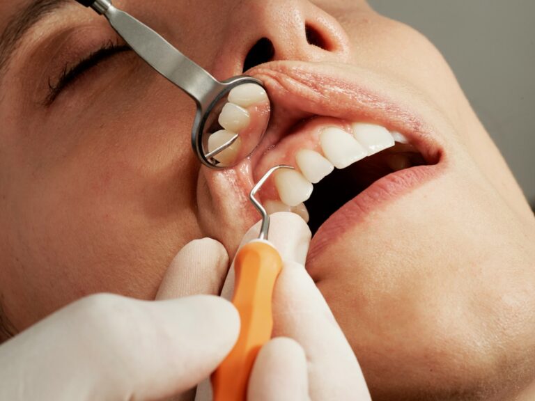 Dlaczego profilaktyka stomatologiczna ma znaczenie? Rola regularnych wizyt u dentysty